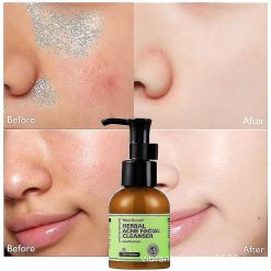 VIBRANT GLAMOUR Herbal Acne Facial Cleanser Acne Treatment 100ml